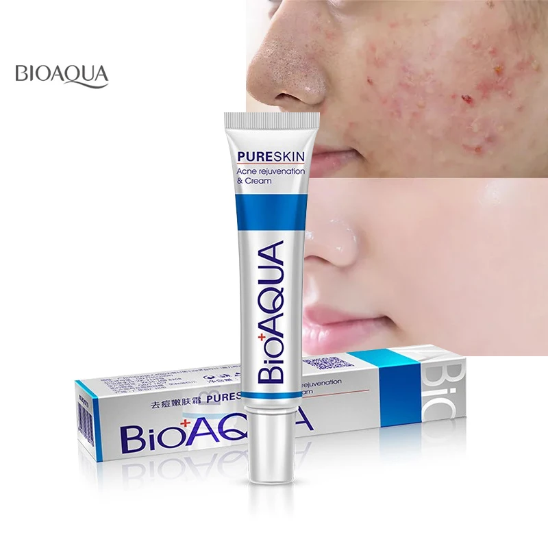 

New face cream whitening skin care anti acne treatment cream oil control Moisturizing Acne Scar Remover Pores bioaqua acne cream