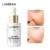LANBENA 24K Gold Anti Aging Set Пептидная Пена Очищающее Средство Для Лица Яркая Сыворотка Красота Крем Для Лица Оригинальный Тонер Свежая Сыворотка Для Глаз 5шт