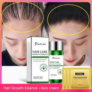 

Putimi Hair Growth Essence Prevent Hair Loss Treatment Ginger Grow Hair Serum Dense Gentle Hair Growth Serum Health Care 20ml