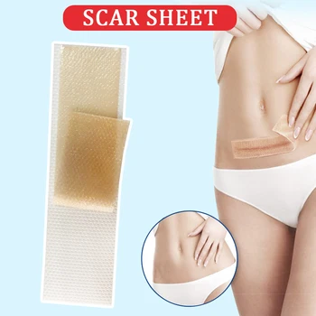 

1pc Trauma Silicone Gel Scar Sheet Skin Repair Postoperative Easy Apply Removal Patch Rehabilitation Cesarean Acne Therapy