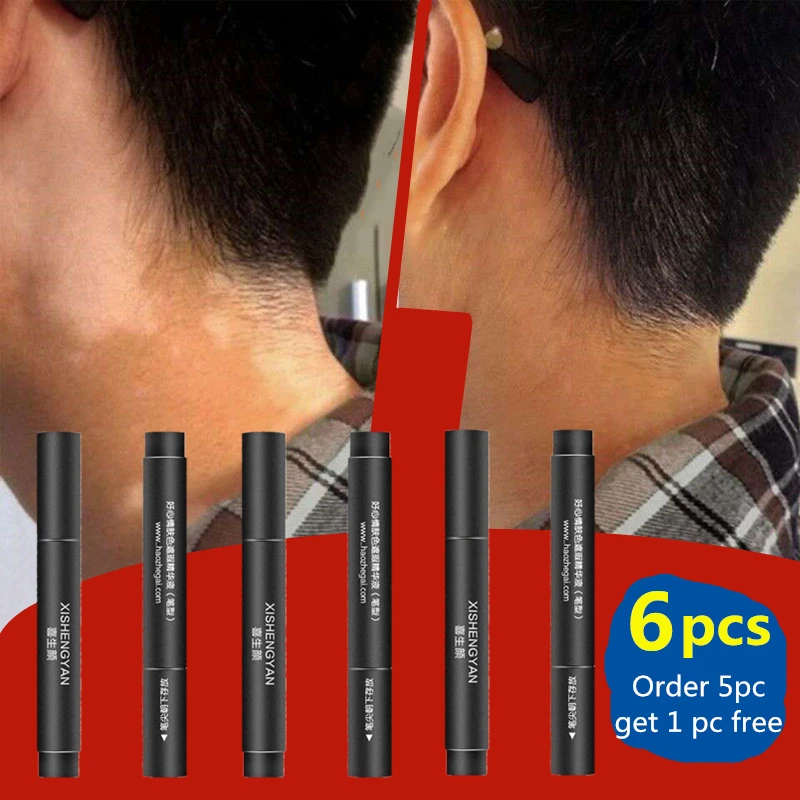 Vitiligo Covering Waterproof Skin Condition Concealer Pen Long Lasting Women Men White Patch Face Body Spots Makeup