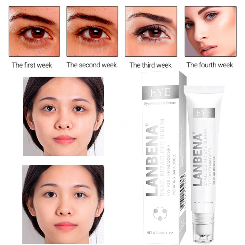 dark circles moisturizer