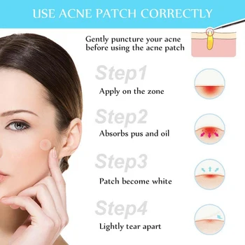 

24 Patches Acne Pimple Master Anti-inflammatory Invisible Acne Patches Face Spot Scar Care Treatment Stickers Masks