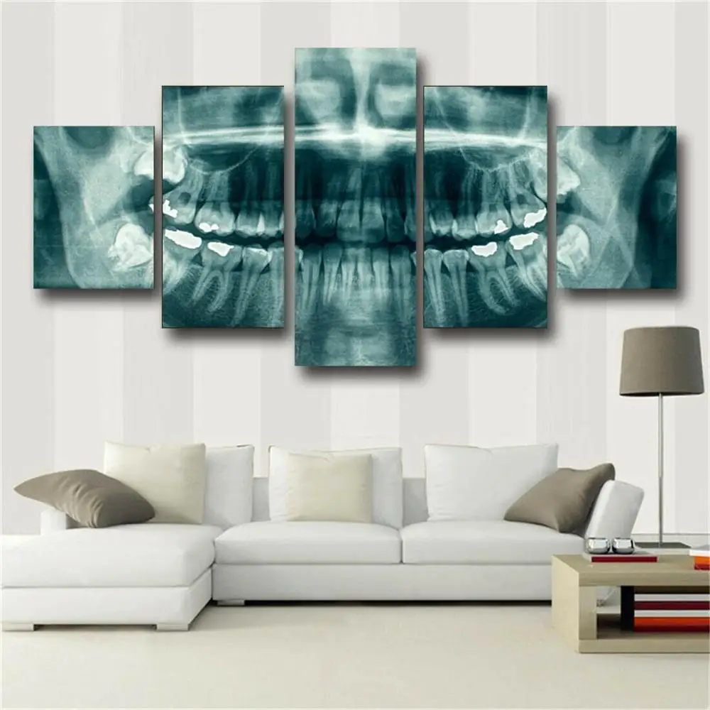 No Framed Canvas 5Pcs Dental Teeth X Ray Wall Art Posters Decorative