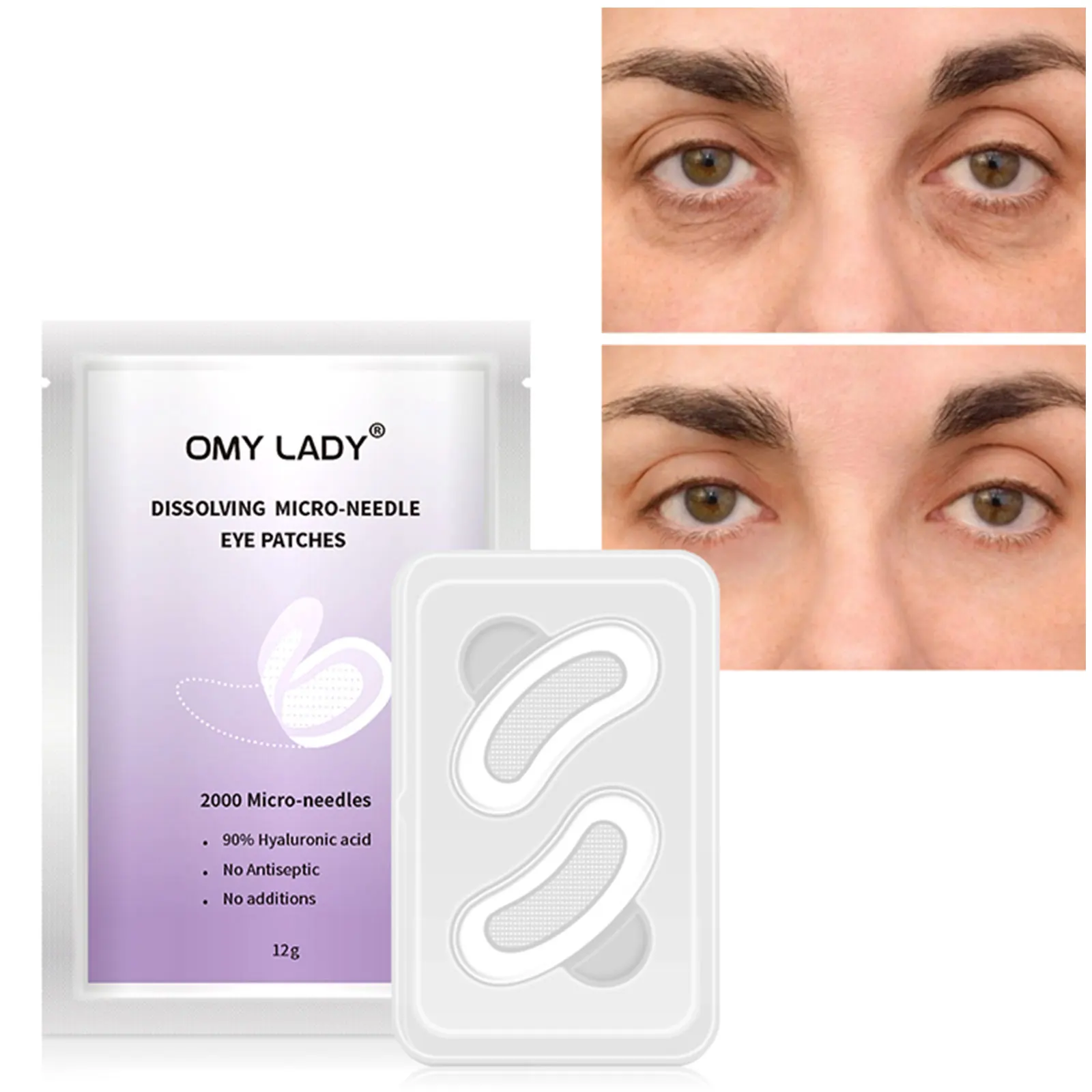 Патчи для глаз OMY LADY1Pair растворяющие микроиглы отбеливание и осветление