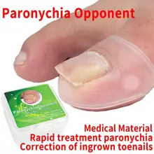 Силиконовый инструмент для коррекции вросших ногтей Невидимый инструмент для лечения вросших пальцев ног эластичный зажим для выпрямления волос инструмент для педикюра 2 шт