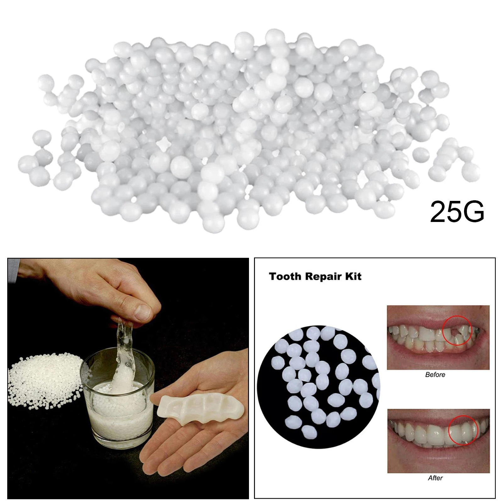 Temporary Tooth Repair Kit Thermal Molding Repair Fitting Bead Denture Repair Fake Teeth Veneer for Filling Missing Broken Teeth