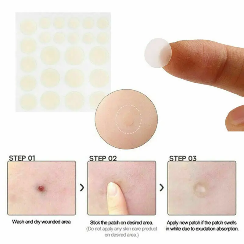 

2019 Newest Skin Tag & Acne Patch - NEW Hydrocolloid Acne and Skin Tag Remover Patches prevent cross infection mini band-aid