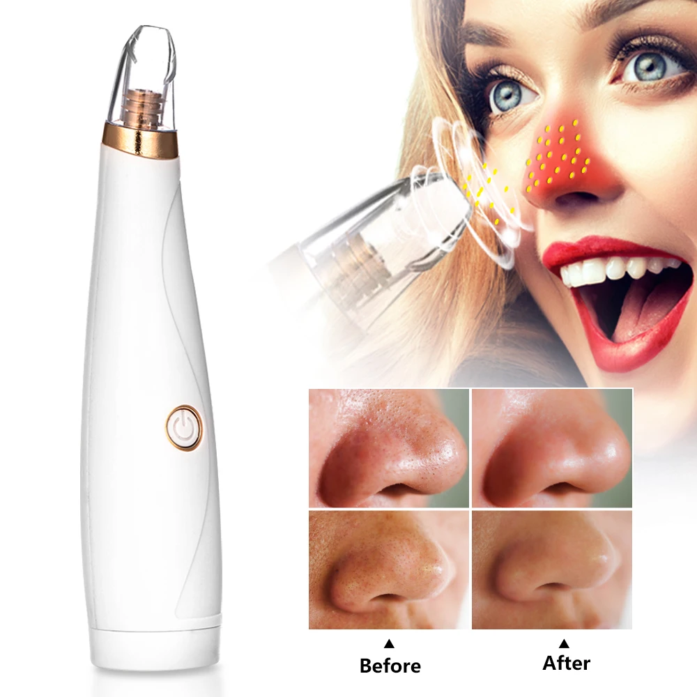 

Blackhead Remover Face Deep Pore Cleaner Skincare Acne Pimple Removal Vacuum Suction Facial SPA Diamond Beautycare Tools