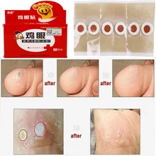 6 штук медицинского штукатурки для удаления колючек для ног, палочки для удаления омертвевшей кожи, пасты для удаления тараканов