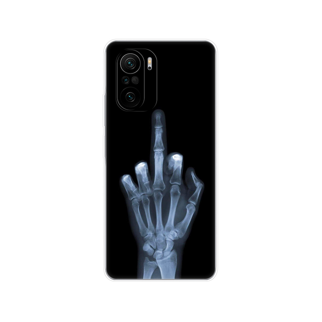 Xiaomi POCO F3 Case For Global Version POCO F3 5G Phone Back Cover On Poco F 3 PocoF3 6.67'' POCOPHONE Silicon Soft TPU