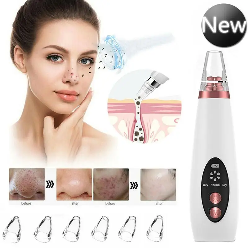 Вакуумный прибор для удаления черных точек с ЖК дисплеем|Устройство ухода за