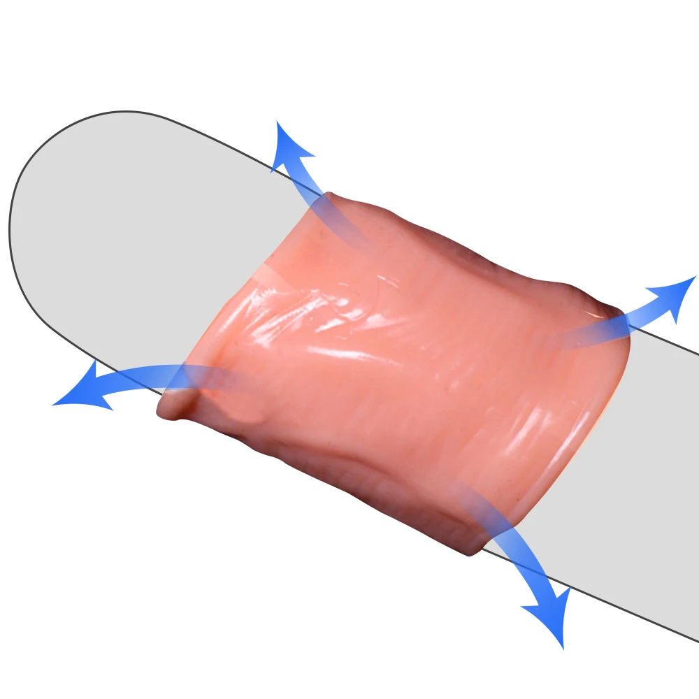 5 шт. кольцо на пенис для коррекции Foreskin два размера в форме винта задержки
