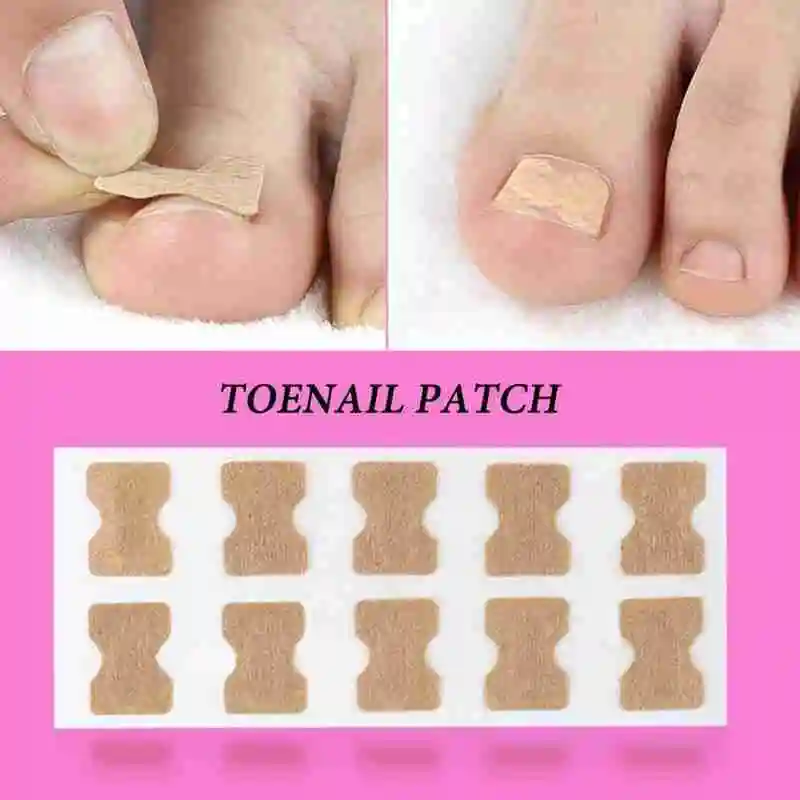 10pcs Ingrown Toenail Corrector Stickers Fingernail Toe Nail Corrector Patch Paronychia Inlays Treatment Care Pedicure Tools Hot