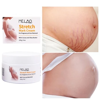 

Stretch Mark Reducers Nourishing Skin Remove Stretch Marks Wrinkles Firming Skin Anti-Stretch Mark Cream Nourishing Skin E1