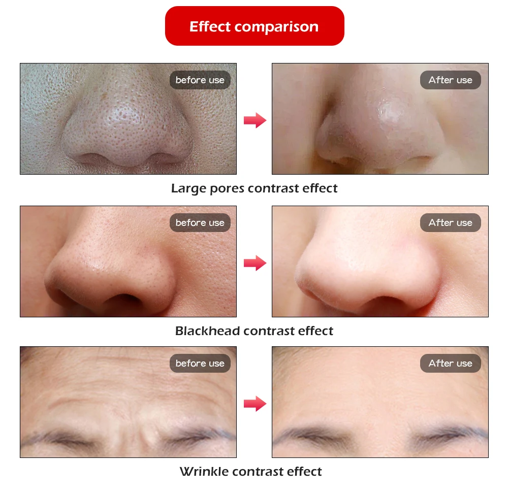  Professional Photon PDT Led Light Facial Mask Machine 7 Colors Acne Treatment Face Whitening Skin R - 32961833851