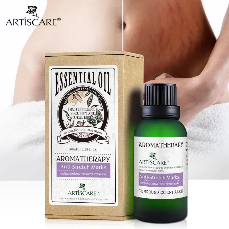 ARTISCARE Anti Stretch Marks essential oil pregnancy repairing, Skin Care, slack line scar