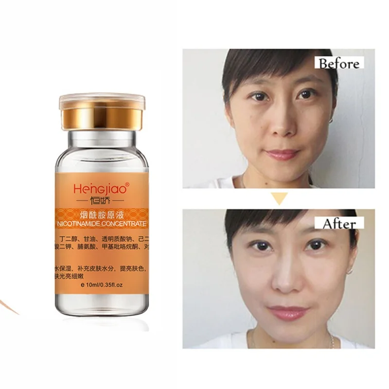 Горячее лицо Гиалуроновая кислота Nicotinamide Astaxanthin эссенция против морщин укрепляющее средство для сужения пор сывороточная эссенция для лица