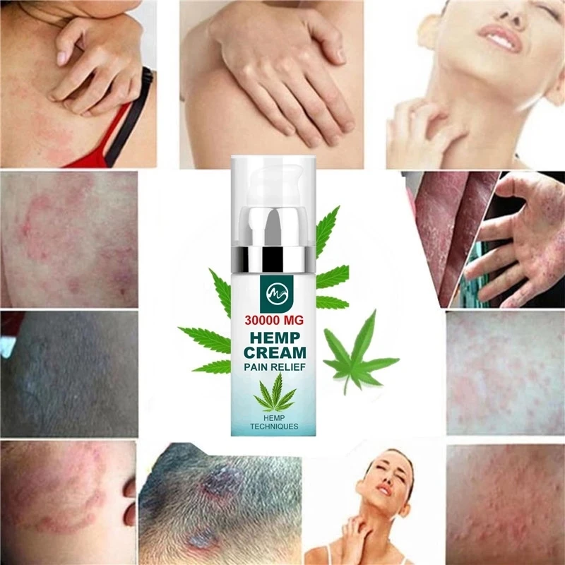Minch-50ml-Pain-Relief-CBD-Hemp-Seed-Cream-For-Neck-Pain-30000-MG-Neck-Relief-Cream.jpg_Q90.jpg_.webp