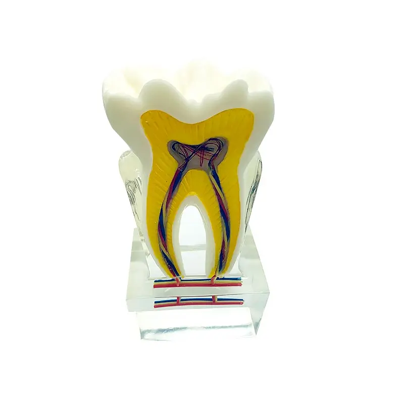 

6 Times Tooth Model with Nerves Dental Model Demonstration Model for Teaching and Studying