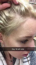 Cuidado del cabello para el crecimiento del cabello aceites esenciales esencia Original auténtico 100% pérdida de cabello líquido salud belleza suero denso para el crecimiento del cabello