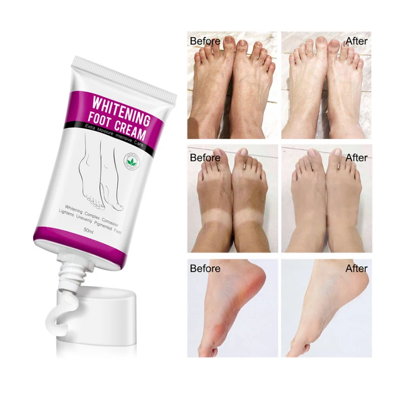 

ALIVER Whitening Foot Cream Moisturizing Hydration to Nourishing Lightens Unevenly Pigmented Feet Creams Skin Care 50ML