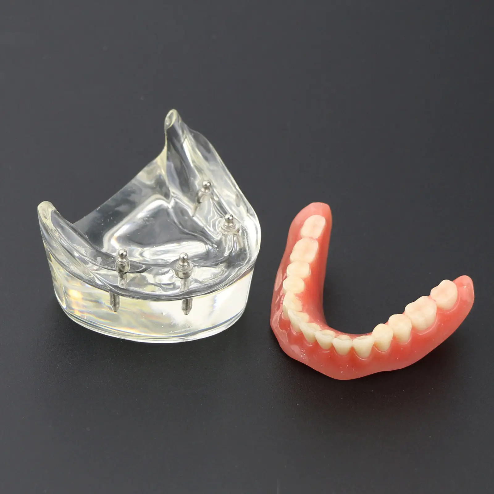 Goedkoop 1Pc Dental Tanden Studie Model Overdenture Inferior 4 Implant Demo Model 6002 02