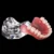 Зубная Модель Зубов Overdenture Съемная Внутренняя Нижняя Челюсть Модель Нижних Зубов Нижняя Челюсть с имплантатом для Обучения Зубам