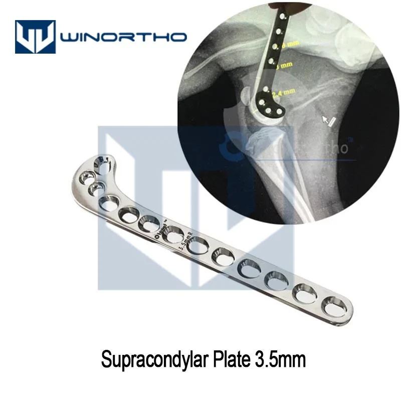 Placas Supracondylar 316L S.S, solo para uso veterinario, Animal PEQUEÑO, ortopédico, instrumento de acetábulo de 2,0mm