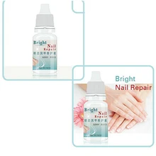 1 PCS 10ml/Bottle Nail Repair Liquid Finger Repair Nail Fungus Onychomycosis Removal Treatment Liquid