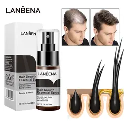 Fast Hair Growth Spray Essence Anti Hairs Loss Care Scalp Treatments Beauty Hair Grow Prevent Hair Dry Damaged Repair Products