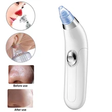 Нос пор глубокий очиститель вакуумное Очищение лица средство для удаления прыщей и угрей набор инструментов Прямая поставка