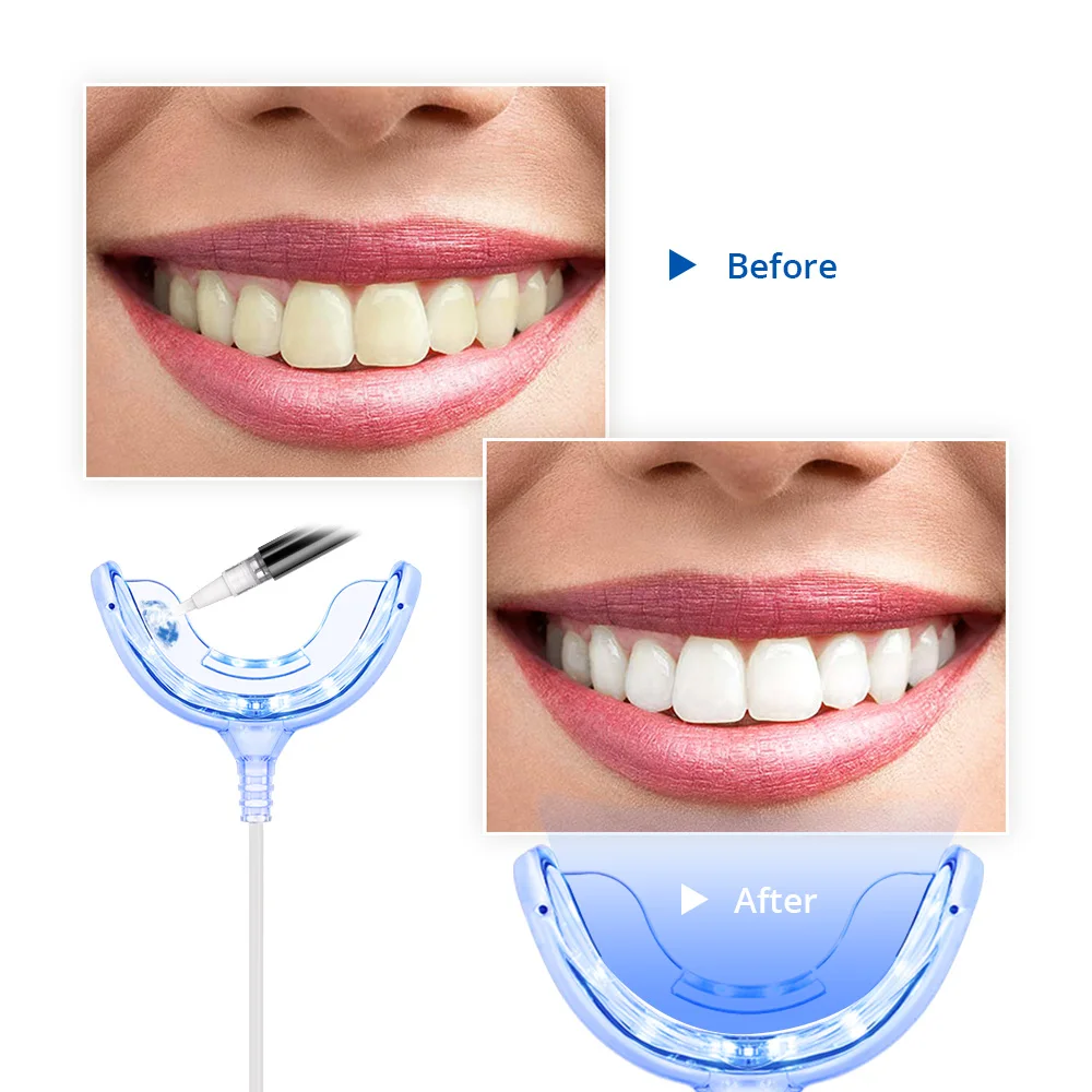 

Teeth Whitening LED Light Portable Smart Timing Home Using Cold Blue Light Trays Device Dental Equipment for Android IOS Type-C