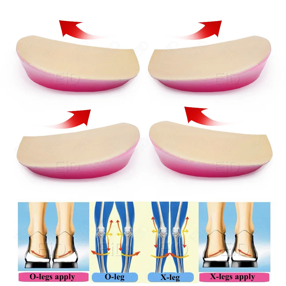 XO Legs Orthotic Insoles Arch Support Silicone Flat Foot Corrector Shoe Cushion Insert Gel High Heel Pads