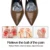 2шт Sumifun Forefoot Shoe Pad Силиконовый Гель Нескользящие вставки Стельки Супинаторные колодки Высокий Каблук Эластичная Подушка Ортопедическая C1424