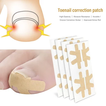

Ingrown Toe Nail Correction Stickers Paronychia Treatment Recover Fingernail Adhesive Tape Straightener Pedicure Tools