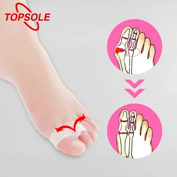 価格 TOPSOLE シリコーンインソール大外反母趾外転 Hemfold リリーフ痛み足底筋膜炎治癒足ケアシリコーンインソール O1003