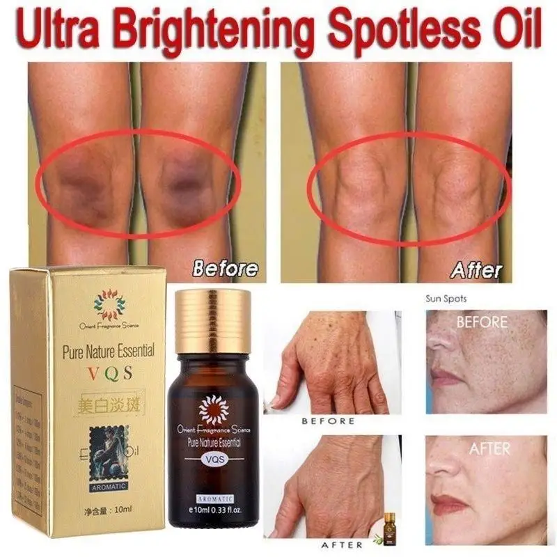 

Ultra Brightening Spotless Oil Skin Care Natural Pure Remove Dark Spots 10ML New