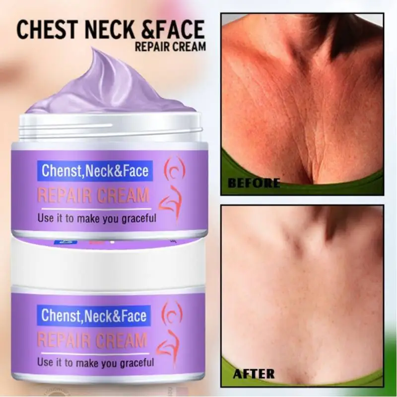 Face And Neck Cream 30g Neckline Cream Wrinkle Smooth Anti Aging Whitening Cream Beauty Wrinkle Firming Skin Becomes Younger