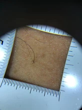 Lupa con mango de dermatoscopio 10X, visión clara suave con escala de medida, 30X, tipo B, visión más grande con luz UV