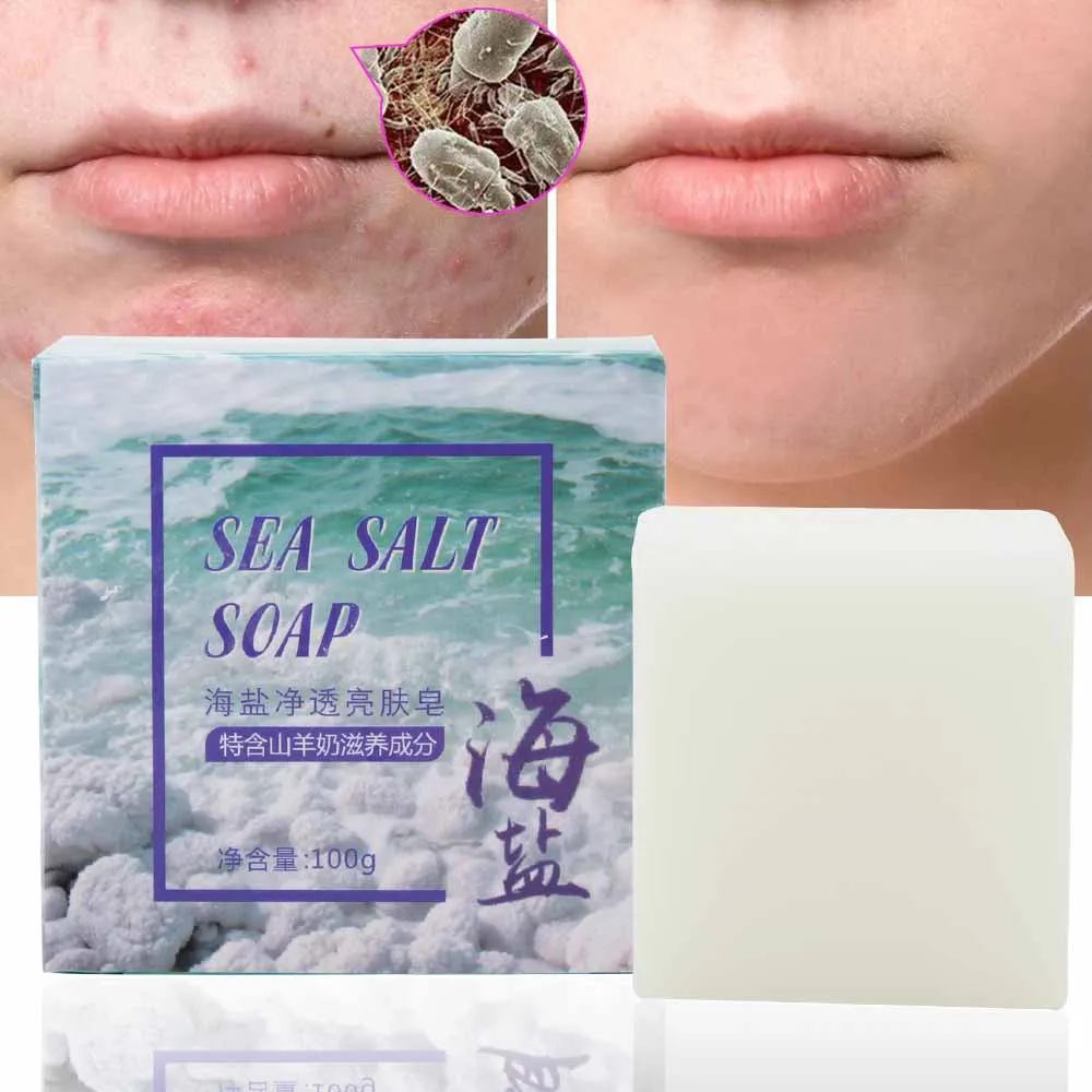 Soap-Base-Removal Whitening-Soap Sea-Salt-Soap Goat Milk Handmade Pimple Face-Skin-Care