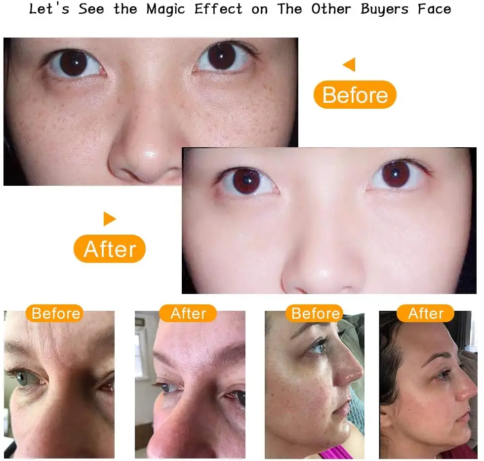 7 In 1 High Frequency Electrode Facial Machine Glass Tube Acne Wand