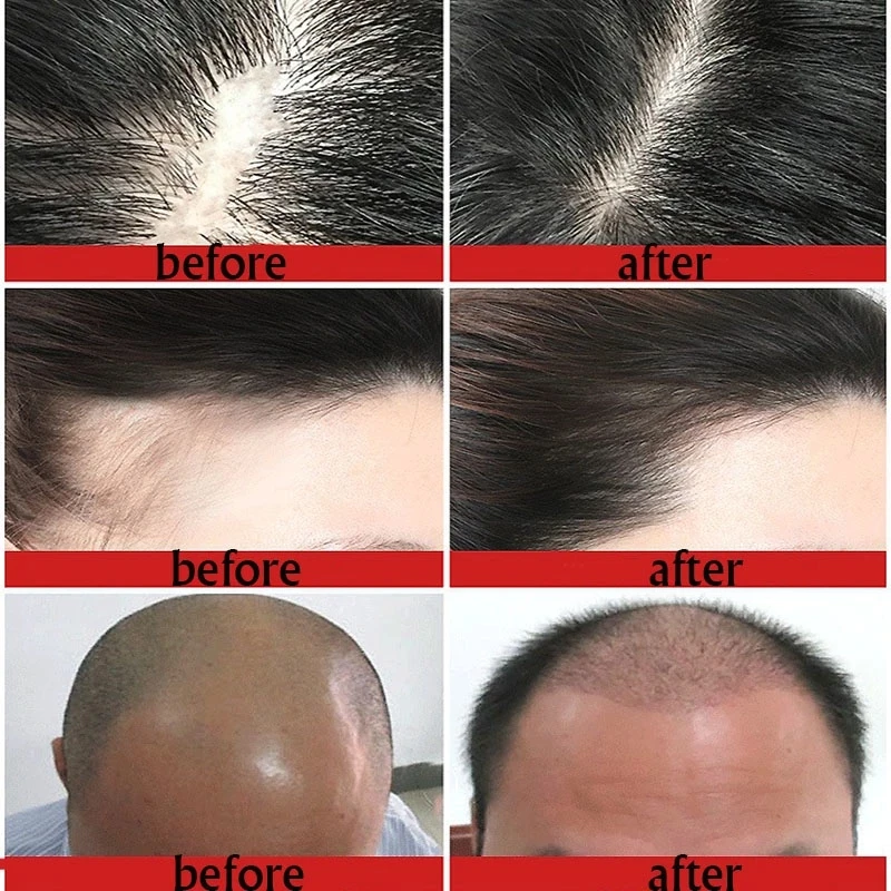 Уход за волосами для роста волос эфирное Масла эссенция оригинальный и