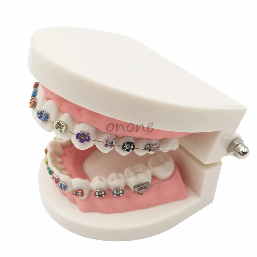 

1pcs Orthodontics Model for Dentist Dental 1/2 Standard Dentition with Full Metal Brackets Teeth Model
