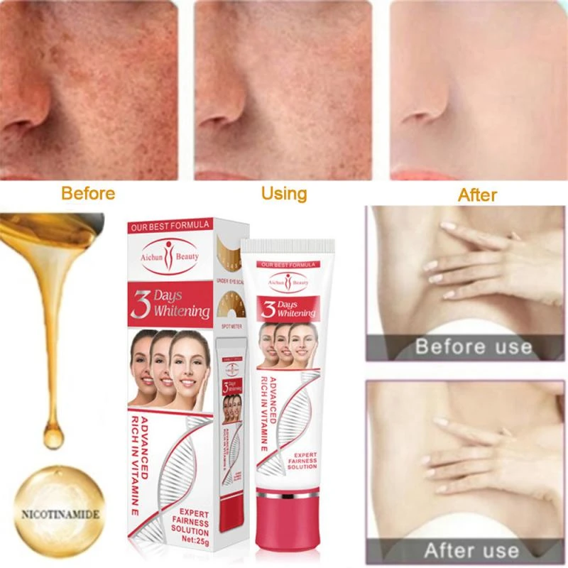 best cream for age spots on the face