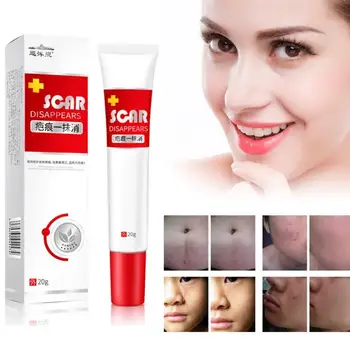 

20ml Scar Treatment Cream Whitening Cream Skin Repair Scar Acne Repair Stretch Treatment Cream Face Cream Q1S6