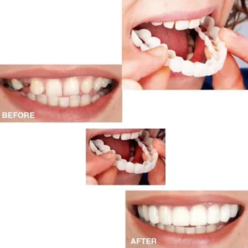 

1PC White Polyethylene Orthodontic Braces Oral Cleaning False Teeth Braces Non-toxic Comfortable Tooth Dentist Tools
