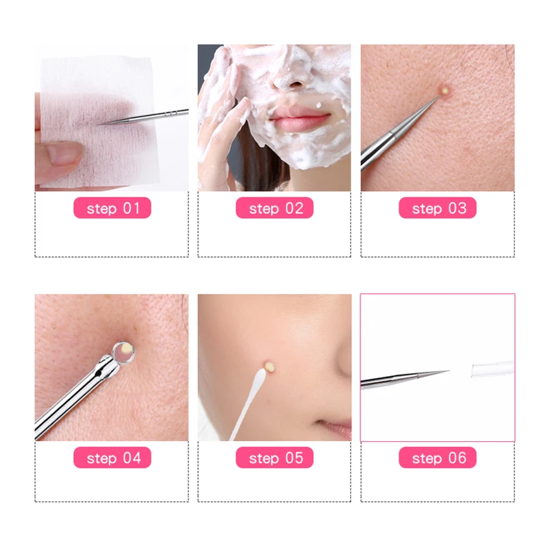 1 Pcs Blackhead Comedone Acne Pimple Blemish Extractor Remover Stainless Steel Needles Remove Tools Face Skin Care Pore Cleaner images - 6