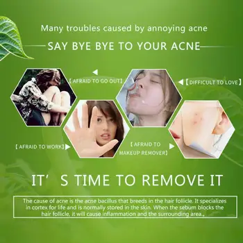 

Acne Treatment Face Cream Anti Acne Scar Removal Pimple Removal Face Cream Blackhead U6I3