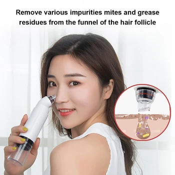 

USB Bubble Vacuum Blackhead Remover With Water Cycle Cleaning Household Extractor Pore Cleaner Removal Facial Cleansing